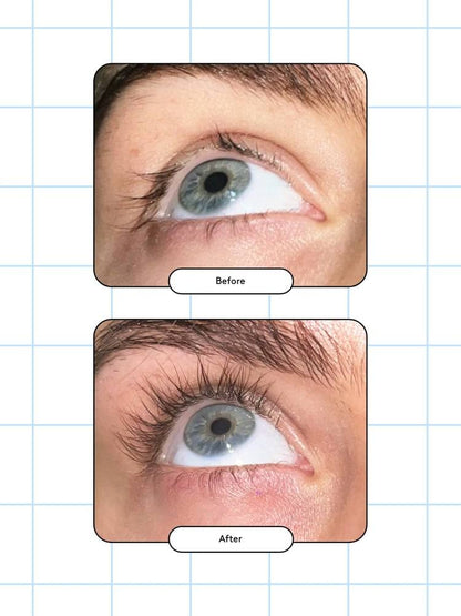 XLASH - Eyelash Serum (Available in 3ml or 5ml)