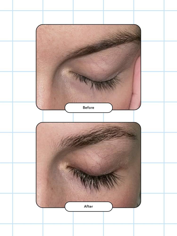 Xlash - Eyelash Growth Serum (3ml or 5ml)