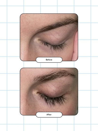 XLASH - Eyelash Serum (Available in 3ml or 5ml)